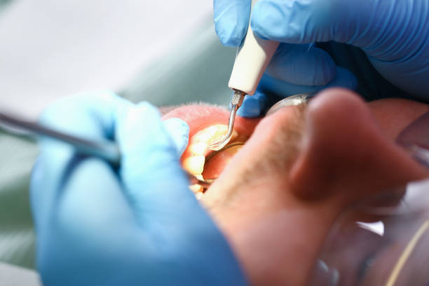 Best Emergency Gum Pain Relief  in Meadow Vale, KY